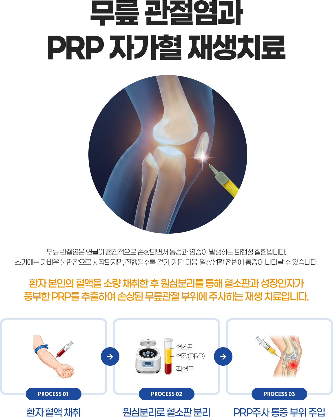 ���� �������� PRP �ڰ��� ���ġ��